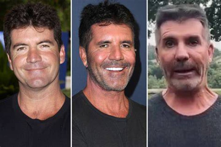 Unveiling the Truth Behind Simon Cowell's Son Illness